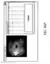 Fig. 49 - SYSTEMS AND METHODS FOR ENHANCEMENT OF RETINAL IMAGES