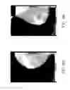 Fig. 08 - Systems and methods for interleaving series of medical images