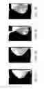 Fig. 09 - Systems and methods for interleaving series of medical images