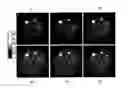 Fig. 01 - Regularization of images