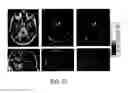 Fig. 49 - Regularization of images