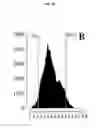 Fig. 09 - Quantitating disease progression from the MRI images of multiple sclerosis patients