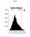 Fig. 12 - Quantitating disease progression from the MRI images of multiple sclerosis patients