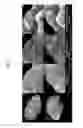 Fig. 22 - Quantitating disease progression from the MRI images of multiple sclerosis patients