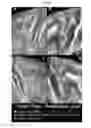 Fig. 24 - Quantitating disease progression from the MRI images of multiple sclerosis patients