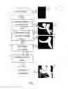 Fig. 02 - System and method for detecting central pulmonary embolism in CT pulmonary angiography images
