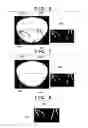 Fig. 06 - Image processing apparatus, image processing method and non-transitory computer-readable medium with calculation of information representing direction of target tissue and with estimating of depicting appearance of target tissue