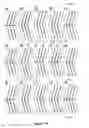 Fig. 16 - Enhanced visual perception through distance-based ocular projection