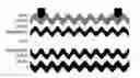 Fig. 01 - Laser assisted SiC growth on silicon