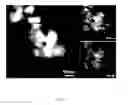 Fig. 07 - Method for making cathode active material of lithium ion battery