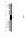 Fig. 17 - Single layer multi mode antenna for wireless power transmission using magnetic field coupling