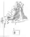 Fig. 02 - Implantable medical device charging