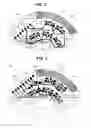 Fig. 03 - Circuit board, motor and electronic power steering system