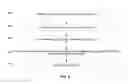 Fig. 07 - Interference cancellation in microwave backhaul systems