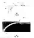 Fig. 07 - Methods and apparatus for inducing a fundamental wave mode on a transmission medium
