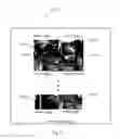 Fig. 07 - System and method for multiplexed video stream decoding in web browser