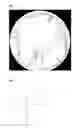 Fig. 02 - METHOD FOR CORRECTING IMAGE FROM WIDE-ANGLE LENS AND DEVICE THEREFOR