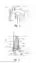 Fig. 04 - Audio headset having arm-to-yoke coupling features and related technology