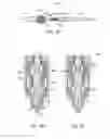 Fig. 03 - Electrode for a contact start plasma arc torch and contact start plasma arc torch employing such electrodes