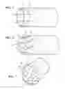 Fig. 04 - Thermal sleeve with reflective positioning member, assembly therewith and method of construction thereof