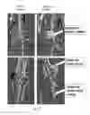 Fig. 08 - Nucleic acid construct for making a genetically modified rodent with an inducible ACVR1 mutation that causes ectopic bone formation