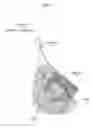 Fig. 02 - Fish Landing Net