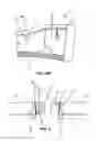 Fig. 06 - Hands free pumping bustier