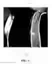 Fig. 04 - Durable reflective safety apparel with active laser illumination