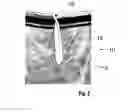 Fig. 03 - Around the neck towel for sweat inducing activities