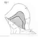 Fig. 02 - Sound insulation structure for a garment