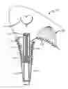 Fig. 01 - Adjustable Shoes