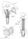 Fig. 02 - Adjustable Shoes