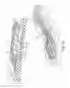 Fig. 12 - Sole structure having auxetic structures and sipes