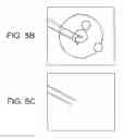 Fig. 06 - Endoscopic surgery image processing apparatus, image processing method, and program