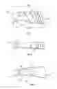Fig. 02 - Surgical tissue protection sheath