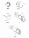 Fig. 03 - Surgical tissue protection sheath