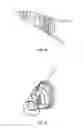 Fig. 10 - Surgical tissue protection sheath