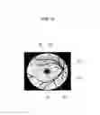 Fig. 09 - Fundus imaging apparatus