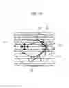 Fig. 34 - Fundus imaging apparatus