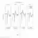 Fig. 03 - SYSTEMS AND METHODS FOR OBJECTIVELY DETERMINING HEARING THRESHOLDS
