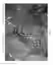 Fig. 07 - Method and apparatus for identifying the ureter during a minimally-invasive procedure