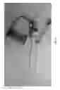 Fig. 10 - Method and apparatus for identifying the ureter during a minimally-invasive procedure