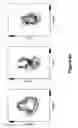 Fig. 13 - Algorithms for gait measurement with 3-axes accelerometer/gyro in mobile devices