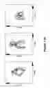 Fig. 19 - Algorithms for gait measurement with 3-axes accelerometer/gyro in mobile devices