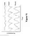 Fig. 24 - Algorithms for gait measurement with 3-axes accelerometer/gyro in mobile devices