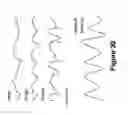 Fig. 40 - Algorithms for gait measurement with 3-axes accelerometer/gyro in mobile devices