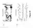 Fig. 42 - Algorithms for gait measurement with 3-axes accelerometer/gyro in mobile devices