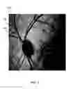 Fig. 02 - Method for detecting a disease by analysis of retinal vasculature