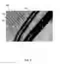 Fig. 03 - Method for detecting a disease by analysis of retinal vasculature