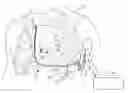 Fig. 01 - Detection of medical electrical lead issues